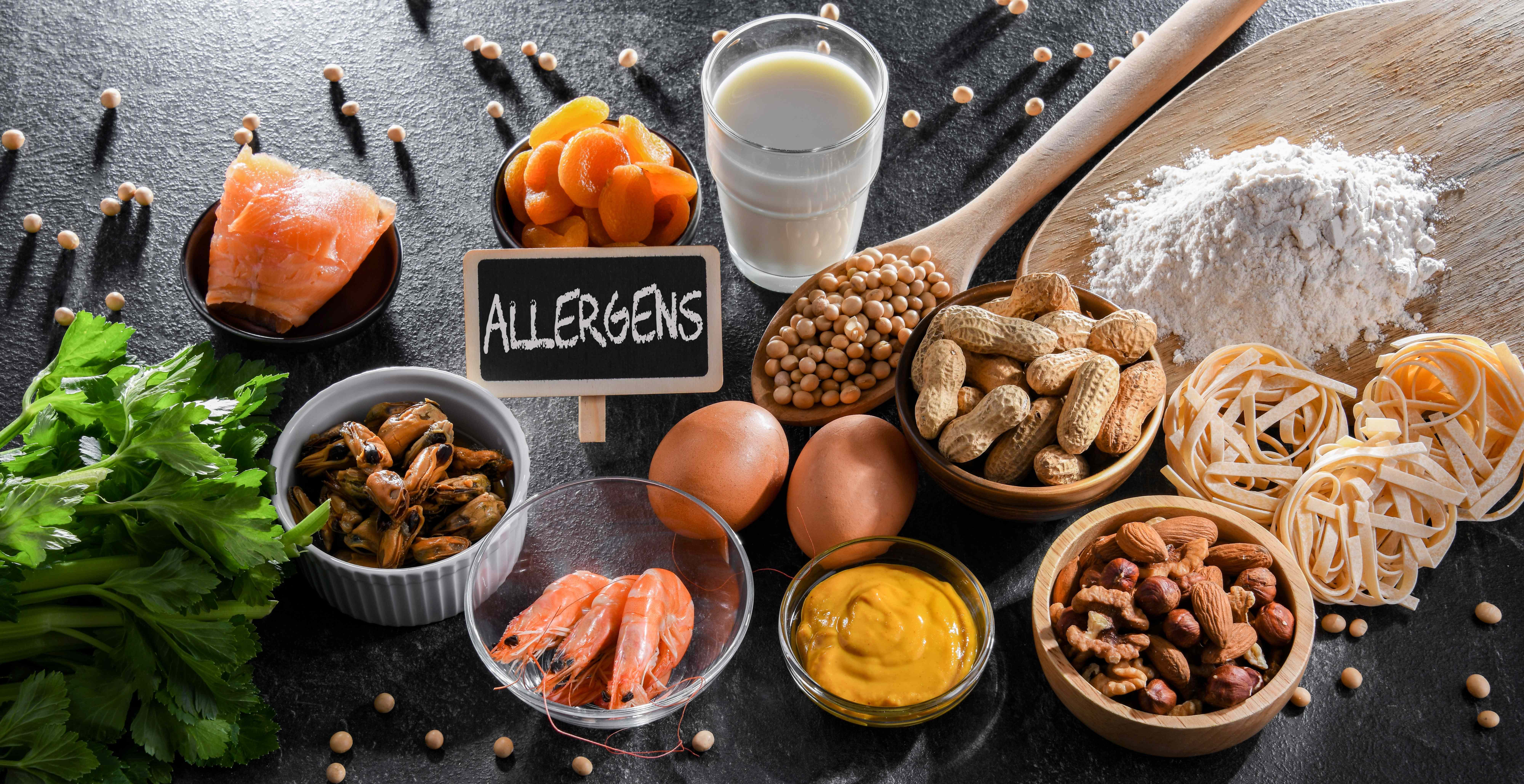 Assortment of common food allergens with an 'ALLERGENS' sign